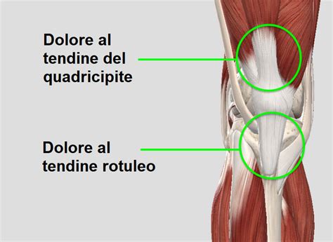 Tendinite Al Ginocchio