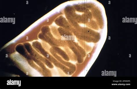 1970s Eggs Parasite Tapeworm Under Microscope Vintage Old Film ...