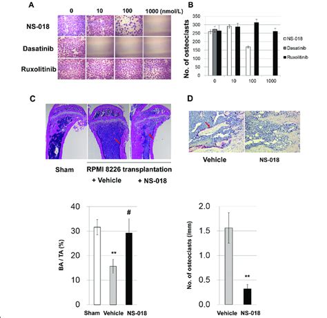 Ns 018 Inhibits Rankl Induced Osteoclast Formation And Suppresses