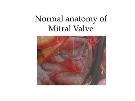 mitral valve anatomy
