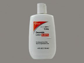 Desonide | Side Effects, Dosage, Uses and More