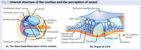 The Senses Hearing Balance And Common Pathologies Of The Ear