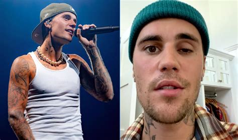 Justin Bieber Reanuda Su Gira Mundial Tras Cancelarla Por Par Lisis