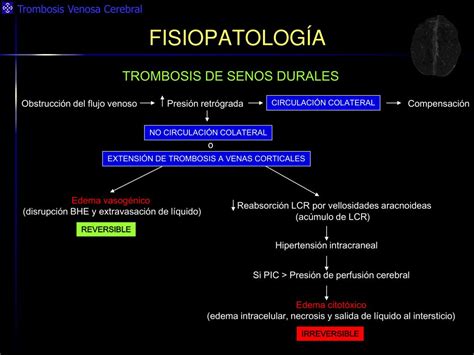 Ppt Trombosis Venosa Cerebral “ Lo Que El Radiólogo General Debe Saber ” Powerpoint