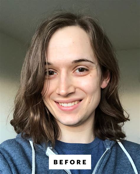 4 Trans Women Share How Facial Feminization Surgery Changed Their Lives