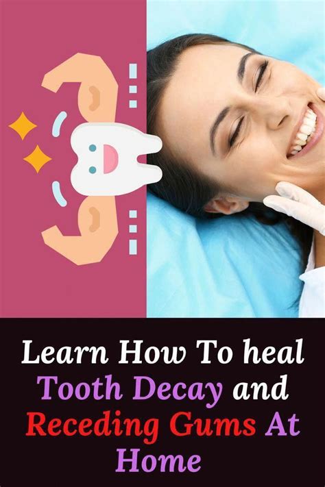 Get Rid Of Cavities And Tooth Decay Artofit