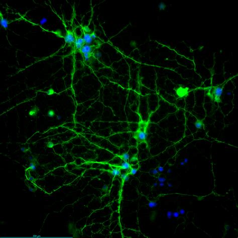 On Chip Neural Differentiation Of Pc Cells Sievewell