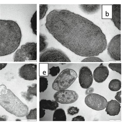 Transmission Electron Microscopic Morphology Of E Coli Cells A