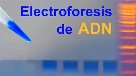 Electroforesis De ADN En Gel De Agarosa IQOG CSIC YouTube