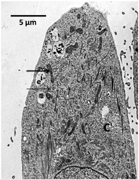 Top 119 Imagenes De Celulas Microscopio Electronico Destinomexico Mx