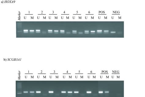 Representative Methylation Specific Polymerase Chain Reaction Msp Download Scientific Diagram