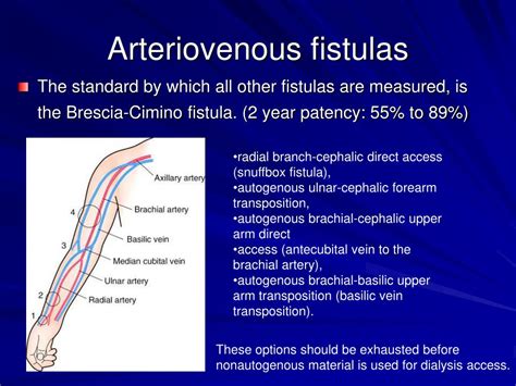 Dialysis Fistula