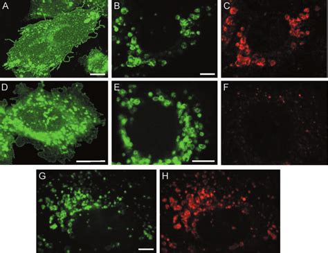 Similar Biosynthetic Trafficking Of MLN64 GFP And START MLN64 GFP In