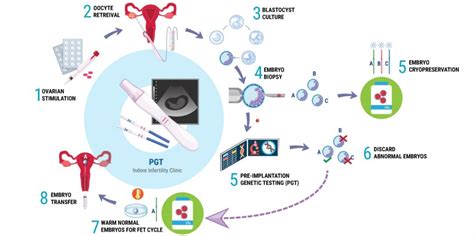 Pgt Cost Of Pgs In Indore Indore Infertility Clinic