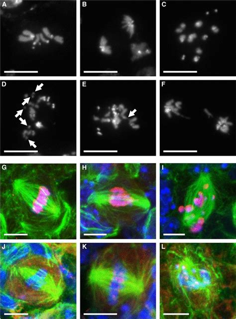 Mitotic Defects In Spdk Cells Af Dapi Stained Mitotic Figures From