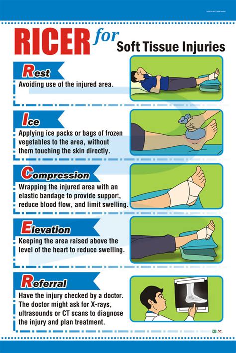 Ricer For Soft Tissue Injuries Progressive Scientific Sdn Bhd