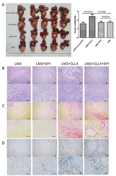 The Nude Mouse Model Bearing Orthotopic Xenografts Was Established The