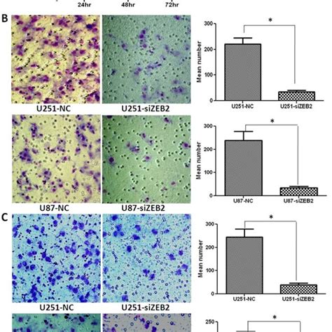 Effect Of Zeb Knockdown On U And U Cell Proliferation As Measured