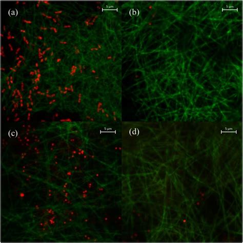 Fluorescence microscopy images scale bar 5 μm of bacteria on