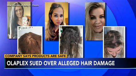 Olaplex Hair Products Left Customers With Bald Spots Blisters Lawsuit Alleges Youtube