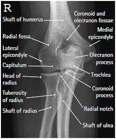 Medical Imaging Technology Radiographic Anatomy Of Elbow