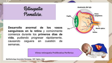 Retinopatia Del Prematuro Como Consecuencia Del Oxigeno PPT