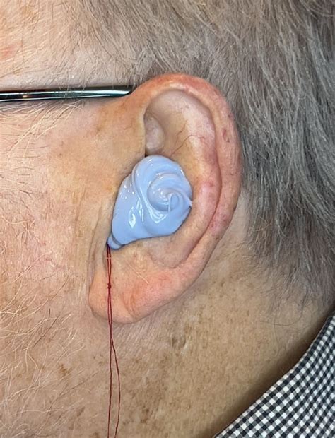 Custom Earmolds And Earplugs Hearing Balance Clinics