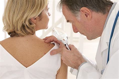 Why Annual Skin Cancer Screenings Are So Important Dermatology Associates Of Central Nj