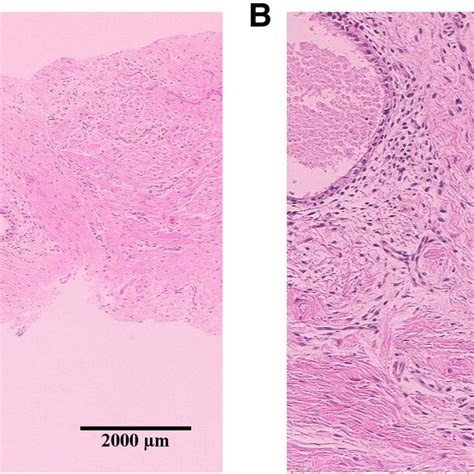 Representative Images Of Hematoxylineosin Staining In The Histological