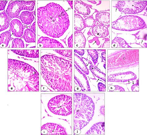 A Photomicrograph Of Section Of The Testes Of Control Rats Showing