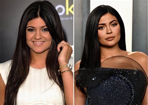 These Before And After Photos Of Kylie Jenner Will Have You Doing A ...