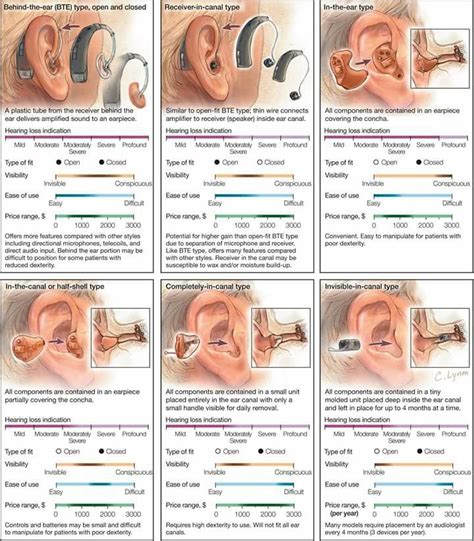 Phonak Hearing Aid Parts Diagram Parts Of A Hearing Aid Diag