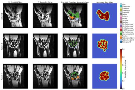 Bioengineering Special Issue Ai In Mri Frontiers And Applications