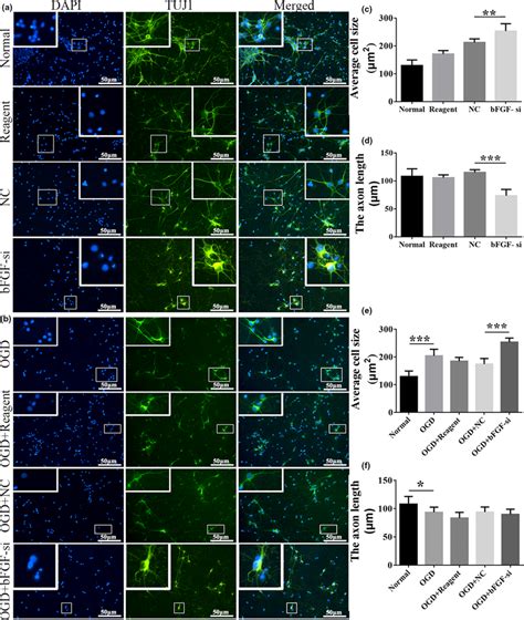 Silencing Of Bfgf Damaged The Morphology Of Cortical Neurons And The