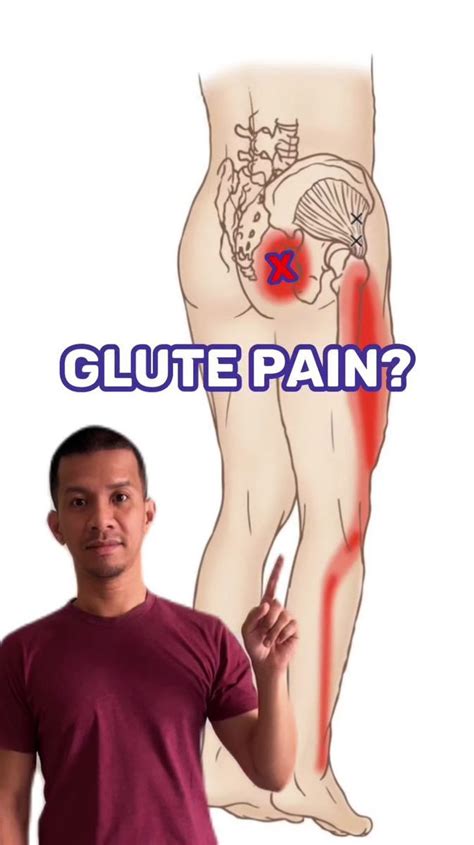 Fix Glute Pain With These 2 Stretches Deep Gluteal Syndrome Is