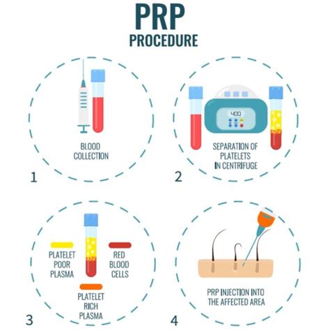 PRP Therapy — Precious Medical Spa (Copy)