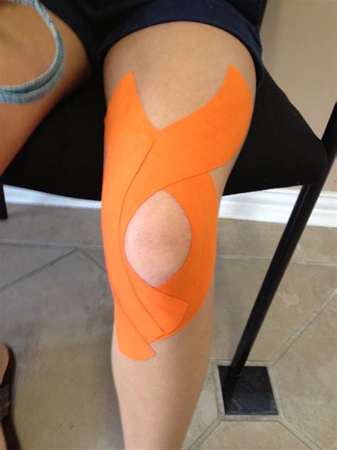 Diagram Diagram Of A Patella Mydiagramonline