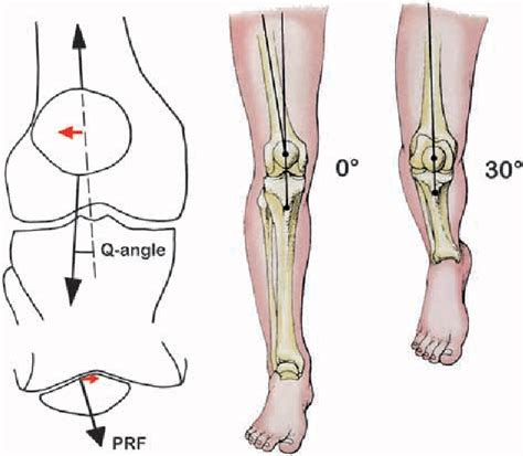 Figure 2 From Basic Kinematics And Biomechanics Of The Patello Femoral