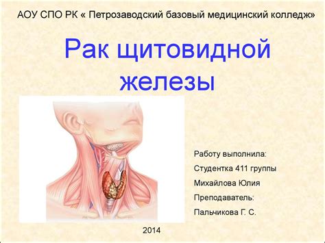 Рак щитовидной железы - презентация онлайн
