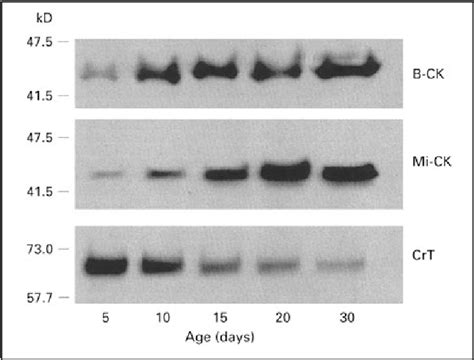 Figure 1 From Brain Creatine Kinase And Creatine Transporter Proteins In Normal And Creatine