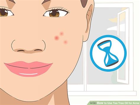 How to Use Tea Tree Oil for Acne: 12 Steps (with Pictures)