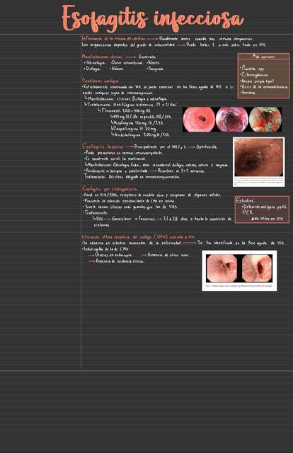 Esofagitis Infecciosa Medicina Zip Udocz