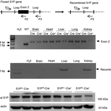 Validation Of Inducible Renal Tubule Specific Deletion Of S1P A