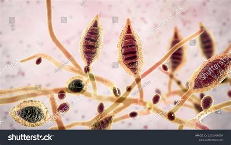 2 Tinea Favosa Images, Stock Photos & Vectors | Shutterstock