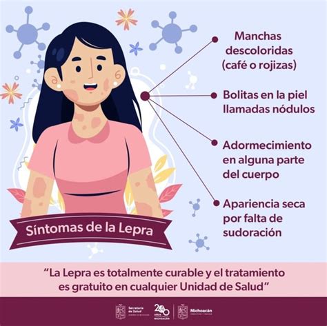 Descubre Los Síntomas De La Lepra Y Recibe Atención Gratuita En Michoacán