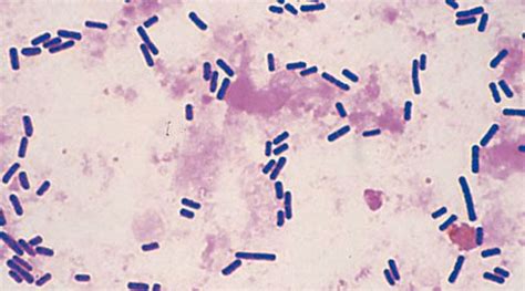 Clostridium perfringens - Alchetron, the free social encyclopedia