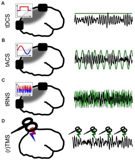 Frontiers Non Invasive Brain Stimulation A Paradigm Shift In