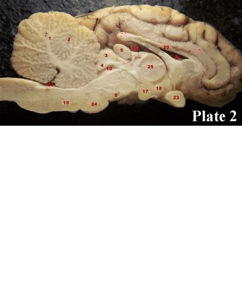 Sheep Brain Pt 2 Diagram Quizlet