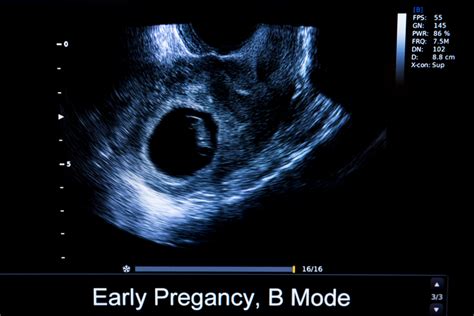 What Is An Abdominal Or Abdomen Ultrasound Two Views