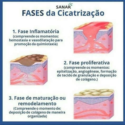 Fases da Cicatrização Anatomia Humana I